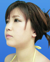 症例NO.