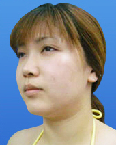 症例NO.