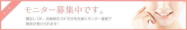 モニター募集