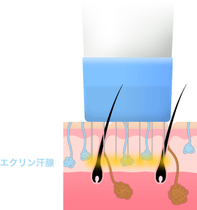 ビューホット