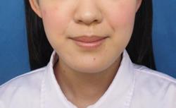 症例NO.