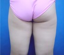 症例NO.