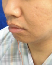 症例NO.