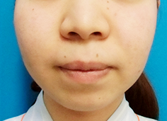 症例NO.