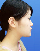 症例NO.