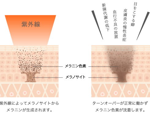 メラニンの図