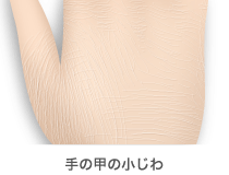手の甲の小じわ