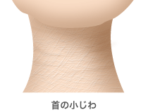 首の小じわ