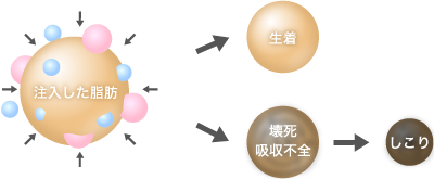 脂肪注入やヒアルロン酸はレントゲンに写る?ばれる?